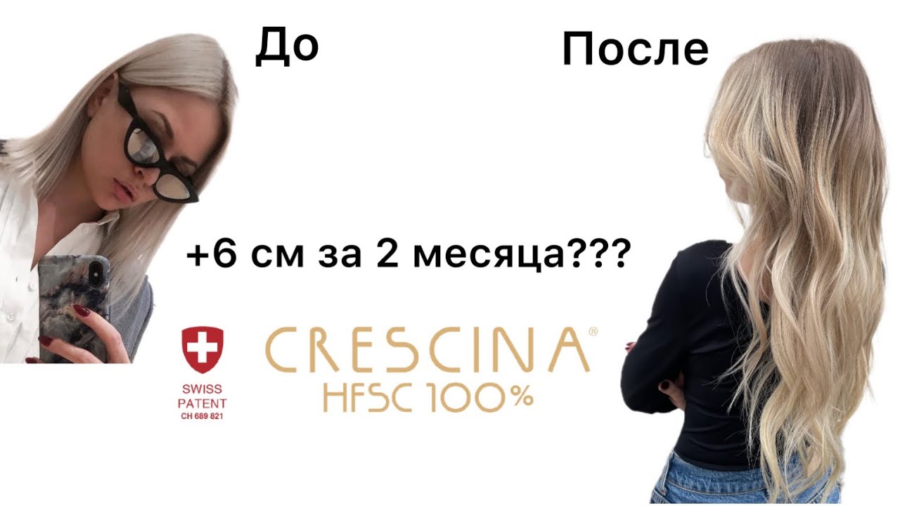 Отрастить волосы за 2 месяца?! CRESCINA мой опыт 👍👎