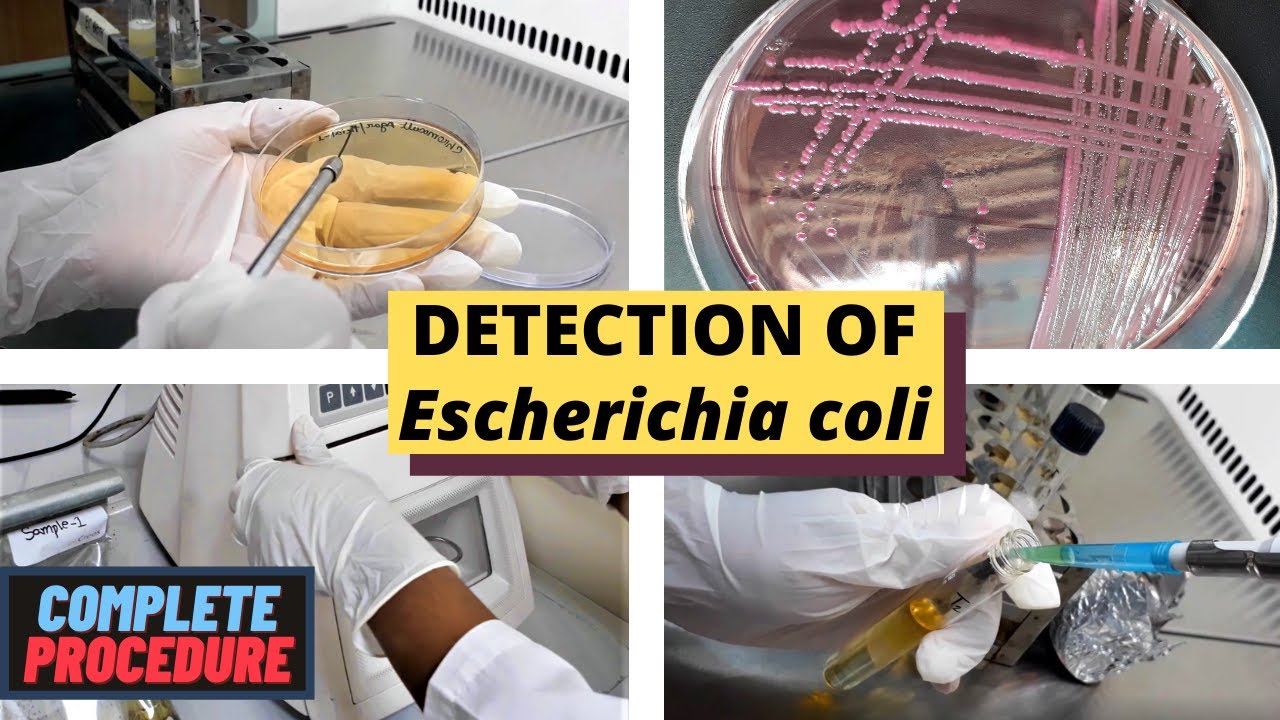 Обнаружение Escherichia coli (E. coli)_Полная процедура (ISO 9308-1 и ISO 16649)