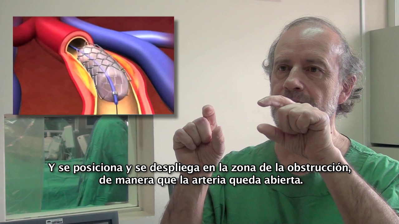 Hemodinamia: procedimientos diagnósticos y terapéuticos
