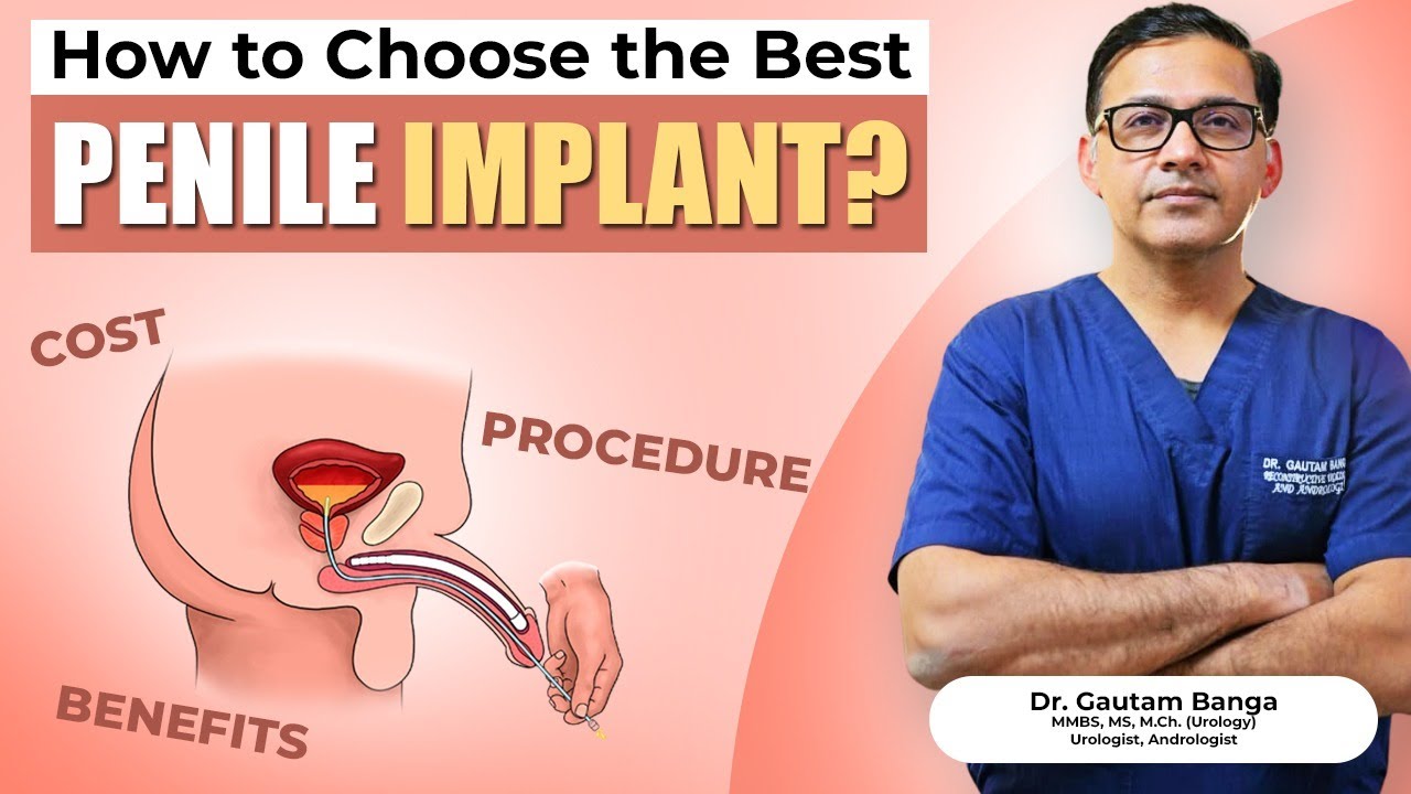 Which is the Best Penile Implant? l Malleable vs Inflatable Implant
