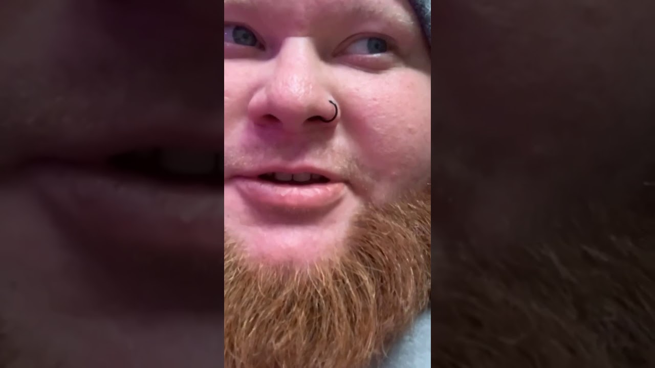 Dog stomps on owners eye while he's relaxing