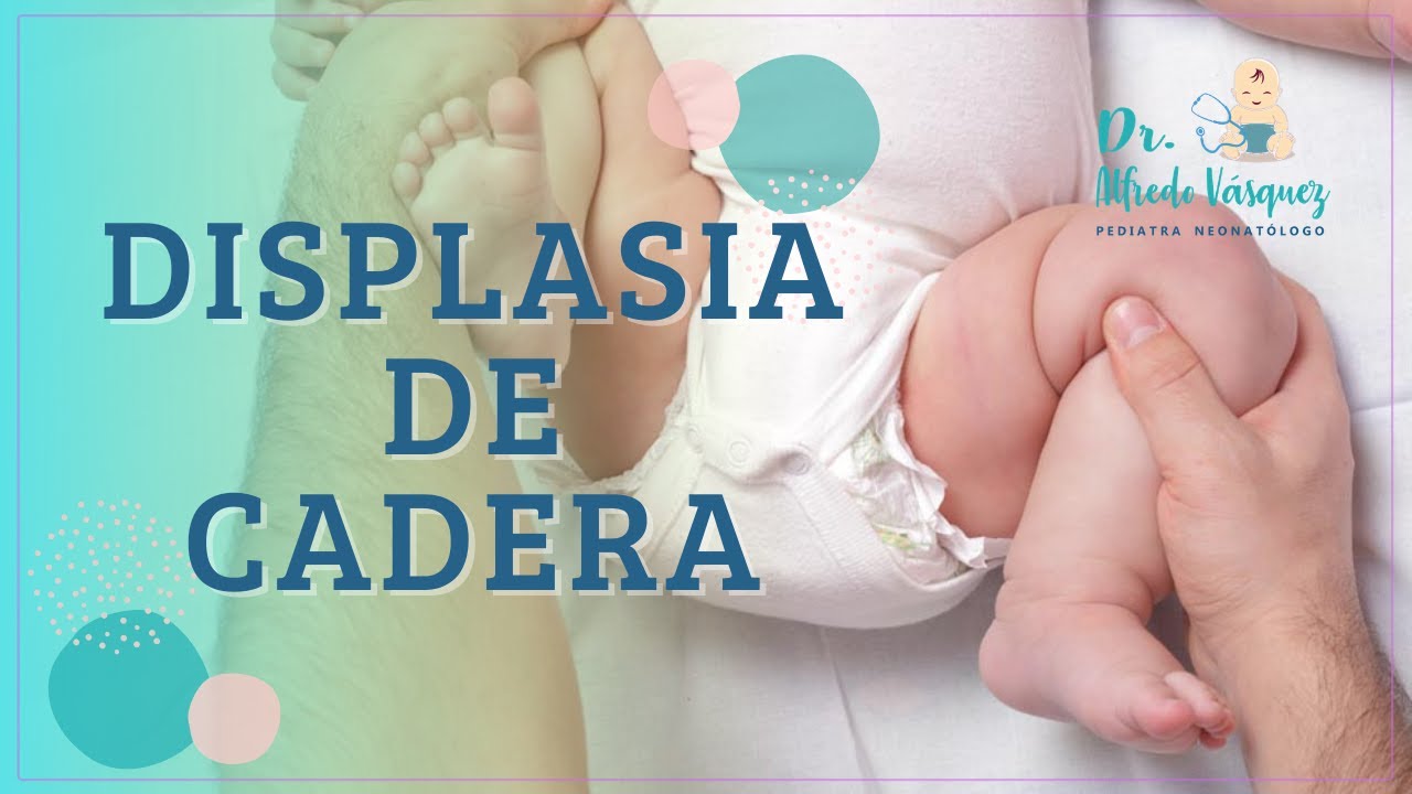 DISPLASIA de cadera en BEBÉS - PEDIATRA NEONATÓLOGO - Cómo detectar?