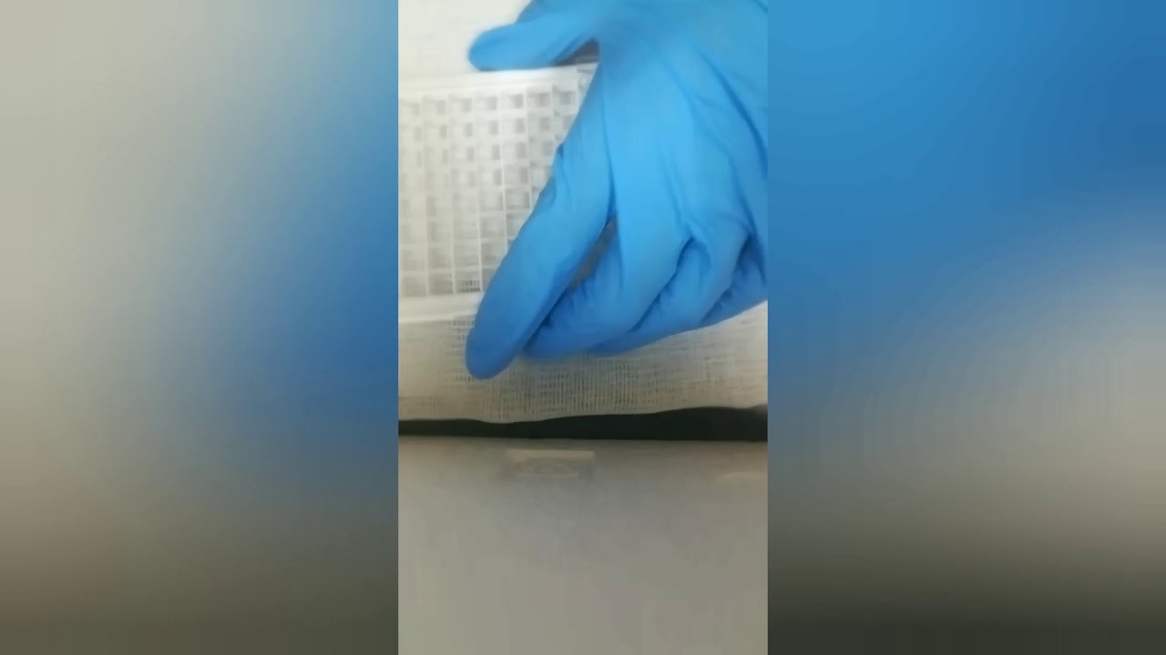 تحليل bhcg elisa عملي الجزء الثاني