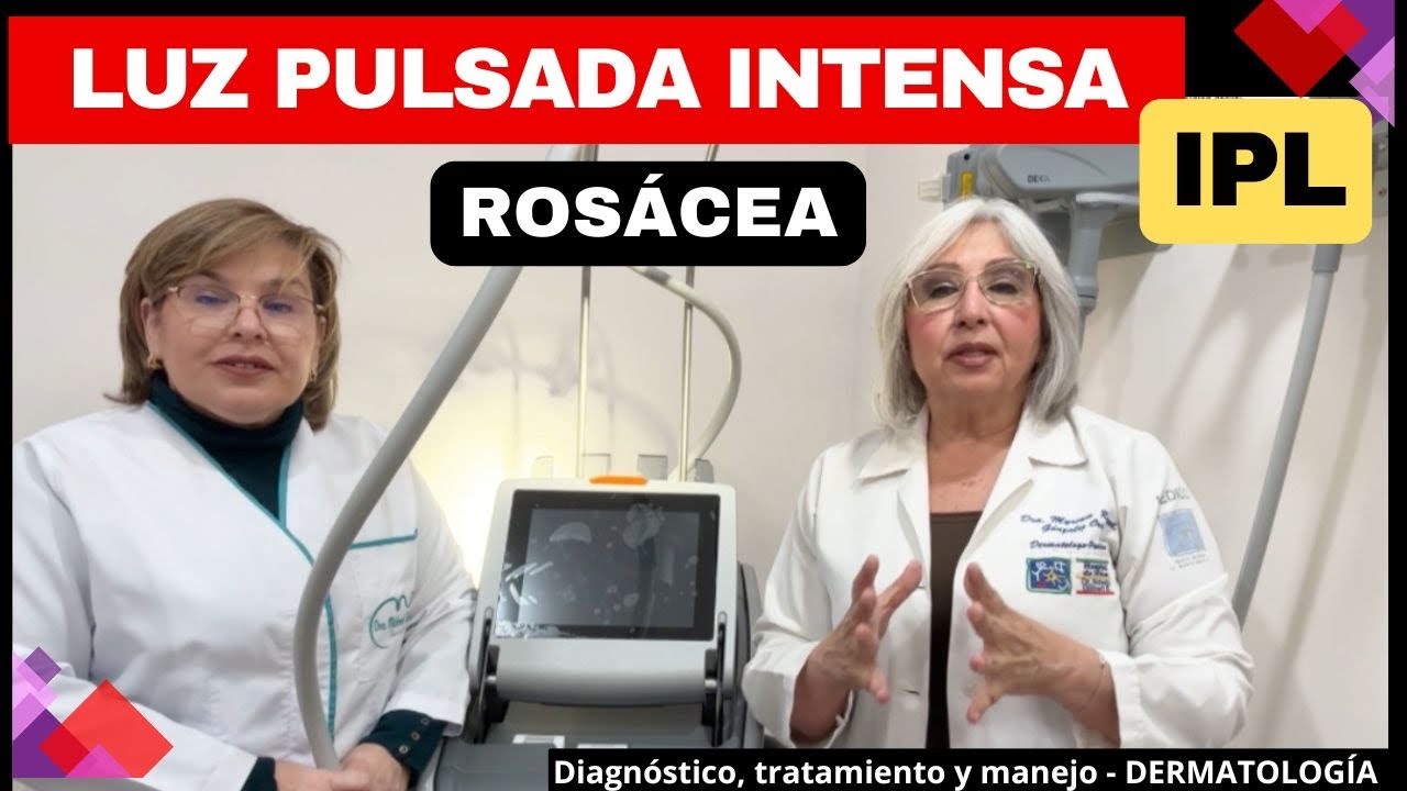 LUZ PULSADA INTENSA (IPL) para ROSÁCEA. @depielapiel
