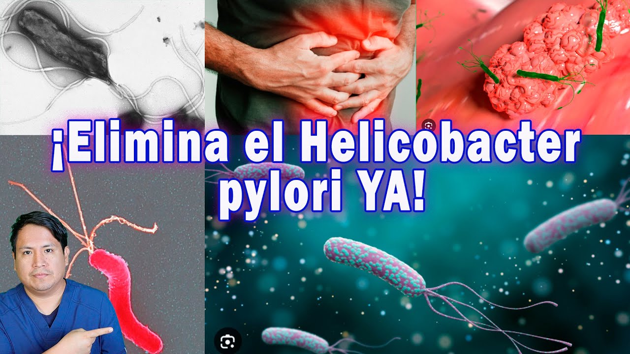 Tratamiento actualizado del Helicobacter pylori lo que debes saber