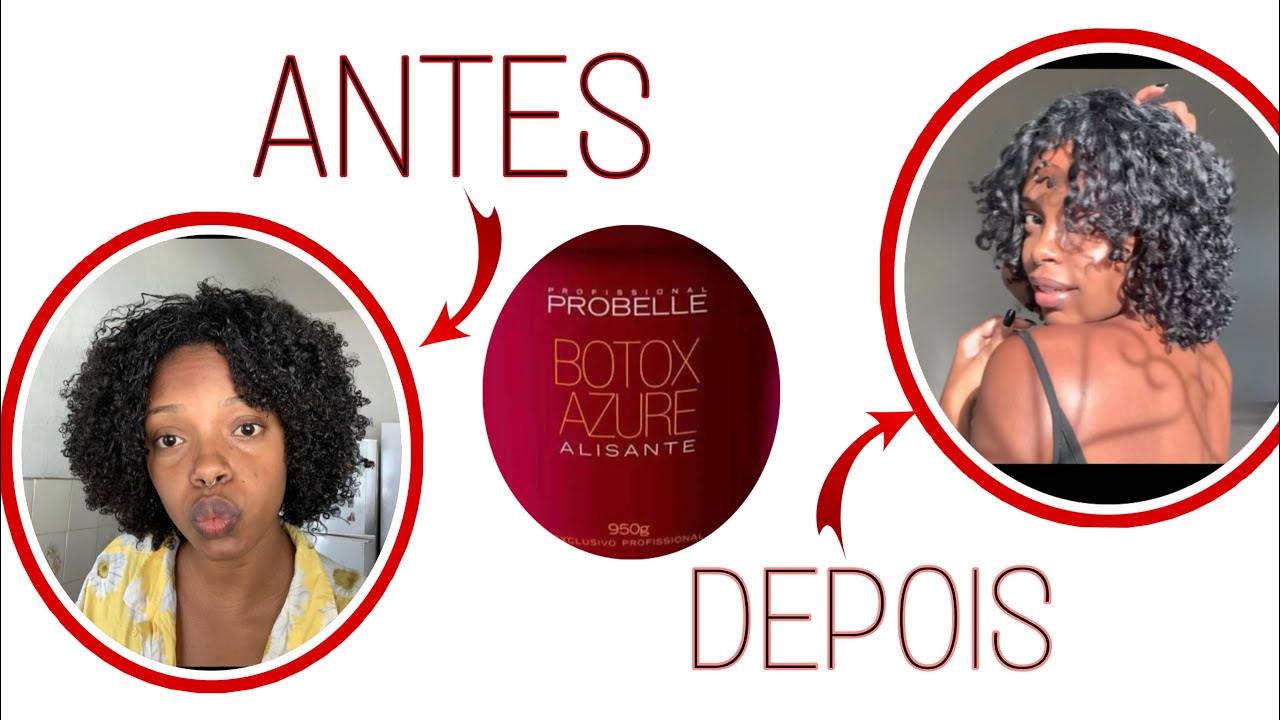 MEU CRESPO TIPO 4 DEPOIS DO BOTOX - por Natalia Donato