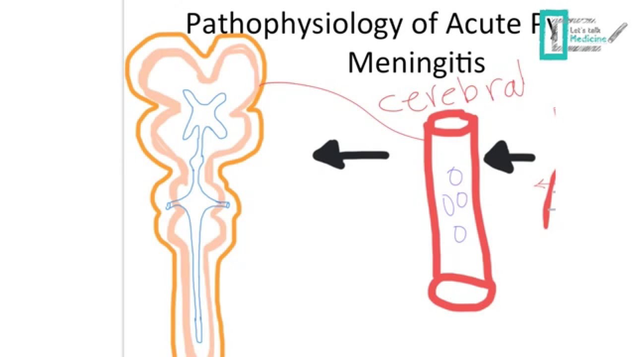 Meningitis Part 1