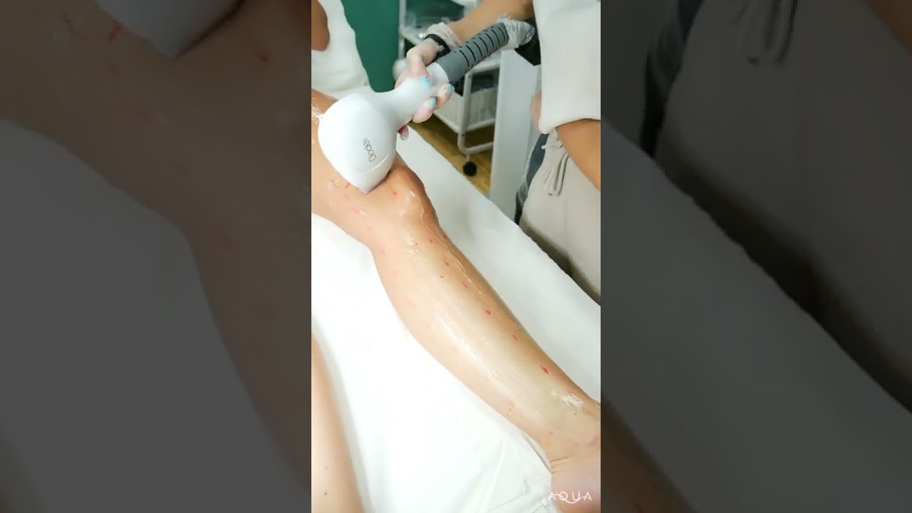 Depilación Láser médico, el Láser definitivo y con la mejor tecnología del mercado, Primelase