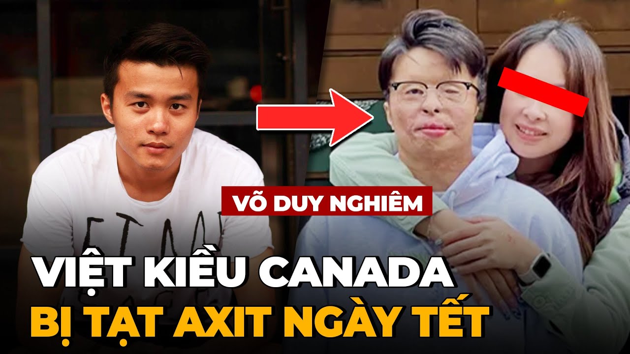 Việt Kiều Canada Bị Tạt Axit Khi Về Quê Ăn Tết - Bi Kịch Của Tình Anh Em? - Vụ Võ Duy Nghiêm