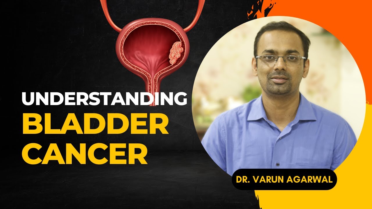 Bladder Cancer: Understanding the Basics, Symptoms, Diagnosis, and Treatment | Dr. Varun Agarwal
