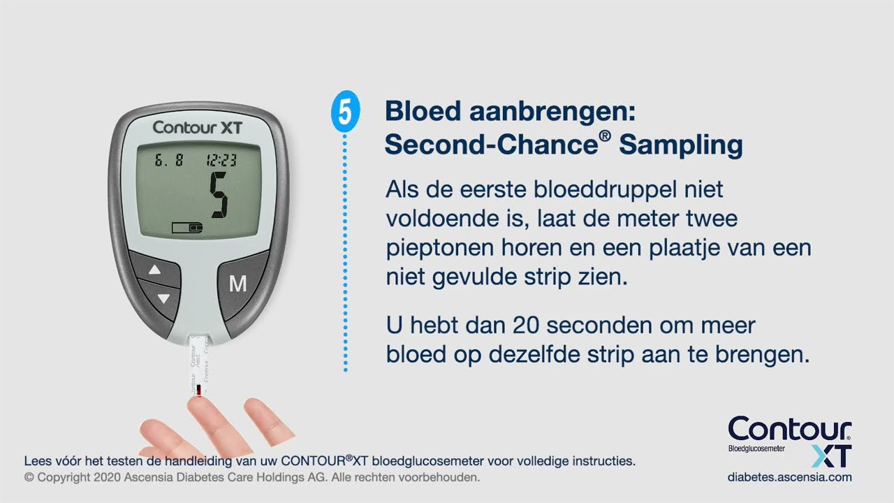 Contour XT Glucosemeter