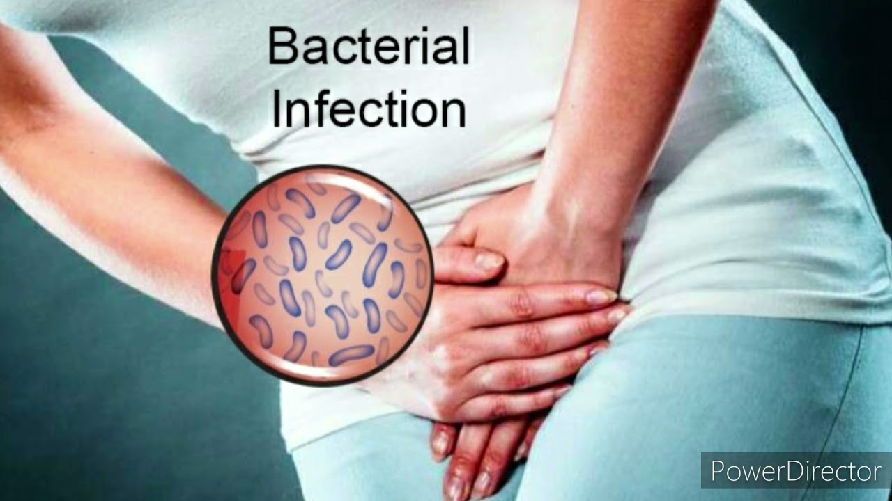 SIFUDUD ISAGA DAAWEE INFECTION IKFASHINKA SOOLALABTA