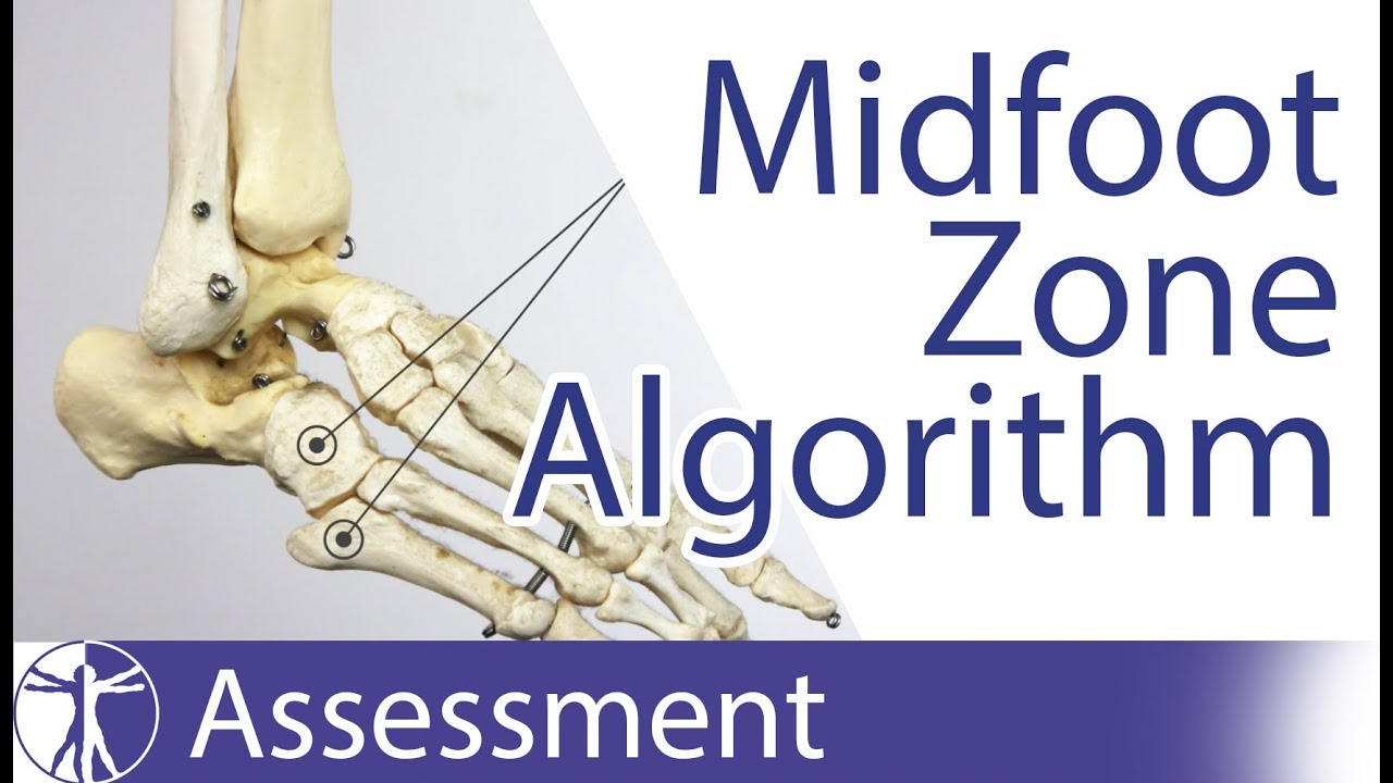 Midfoot Zone Algorithm | Ankle Fracture
