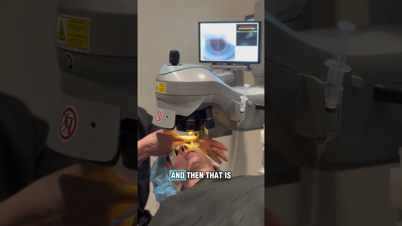 What&rsquo;s it like to have Laser Cataract Surgery? 👀