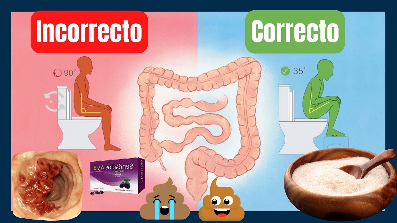 TRATAMIENTO Del Estreñimiento Crónico y Medidas NATURALES