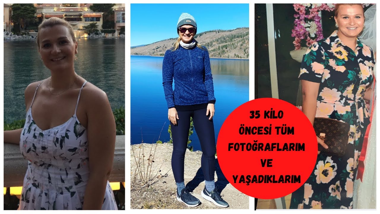 ❗🥳  35 KİLO VERMEDEN ÖNCEKİ TÜM FOTOĞRAFLARIM | ARALIKLI ORUÇ VE ZAYIFLAMA İLE İLGİLİ DENEYİMLERİM❓