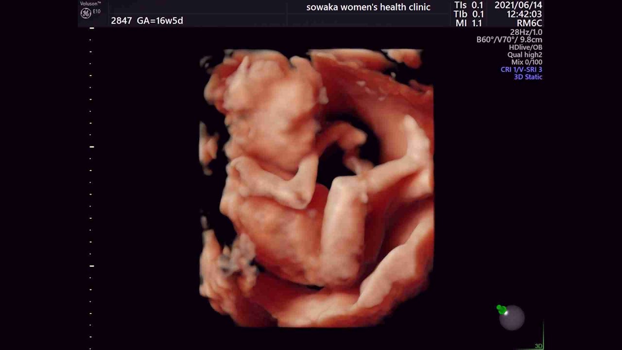 16 week 3D 4D Ultrasound - My baby! ❤️