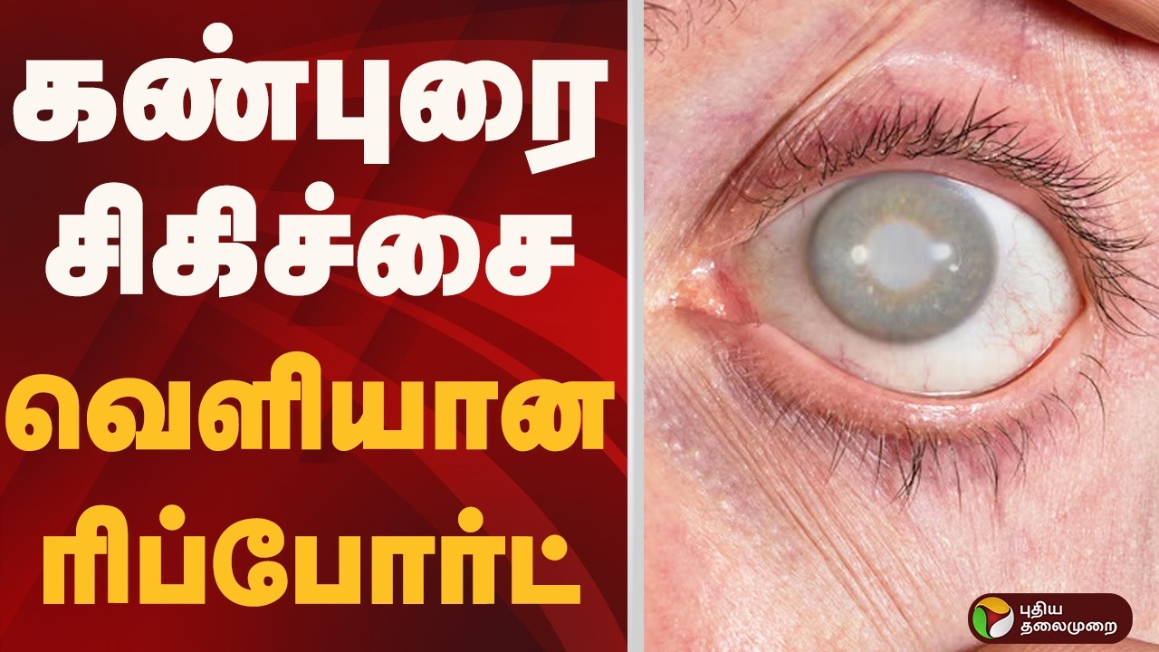 கண்புரை சிகிச்சை.. வெளியான ரிப்போர்ட்