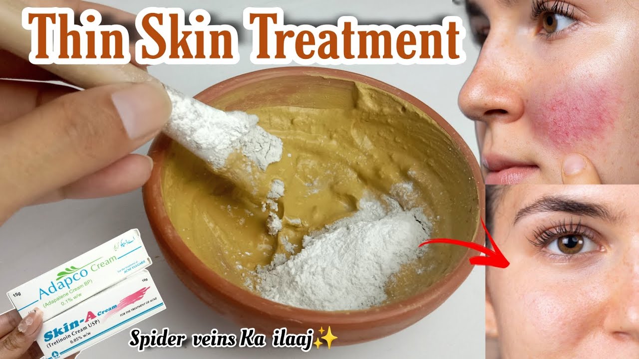 Thin Skin Treatment for Face | Patli Skin Ko Mota Kaise kare | Formula Cream se kharab Skin ka ilaaj
