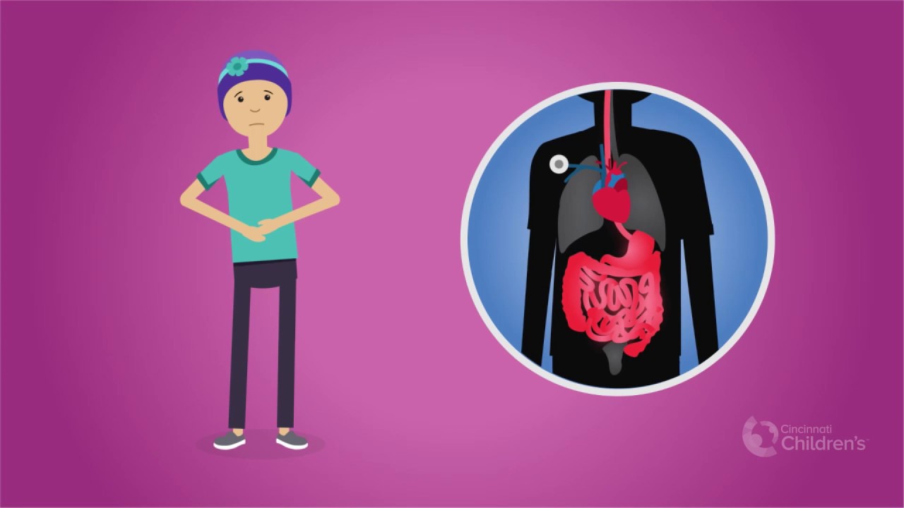 Total Parenteral Nutrition During Cancer Treatment | Cincinnati Children's