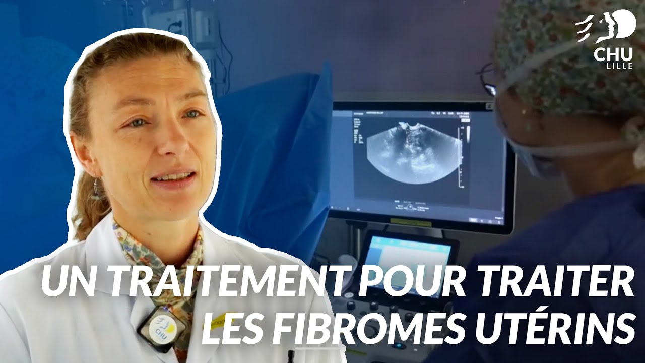 La radiofr&eacute;quence, un traitement r&eacute;volutionnaire pour traiter les fibromes ut&eacute;rins