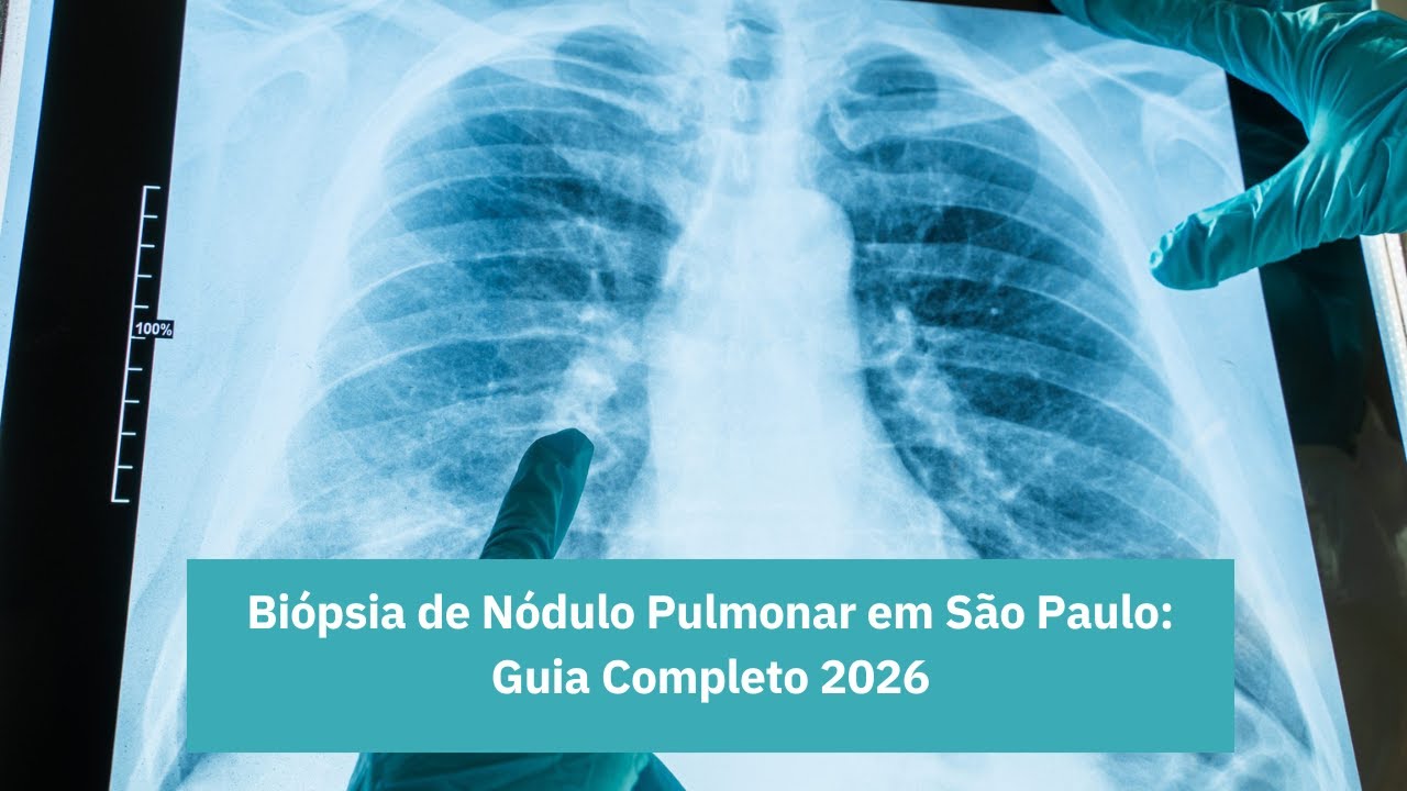 Biópsia de Nódulo Pulmonar em São Paulo: Guia Completo 2026