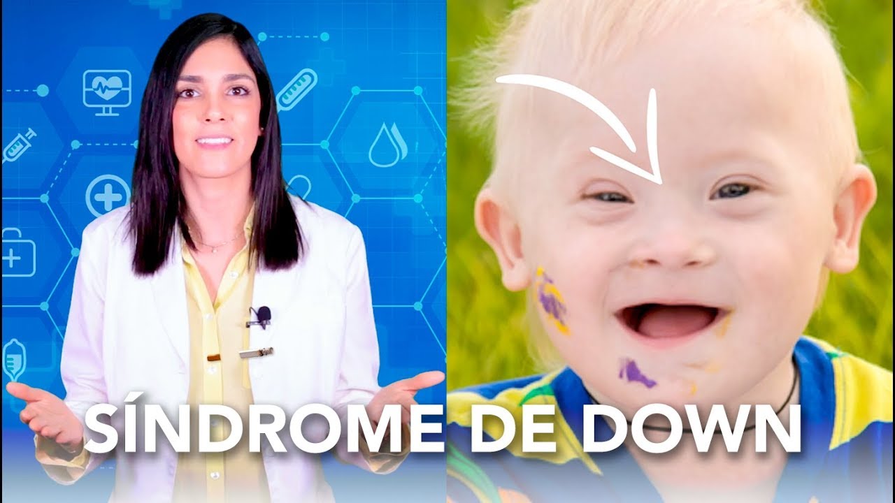 El origen de la trisomía 21| Salud en Corto - Dra Jackie