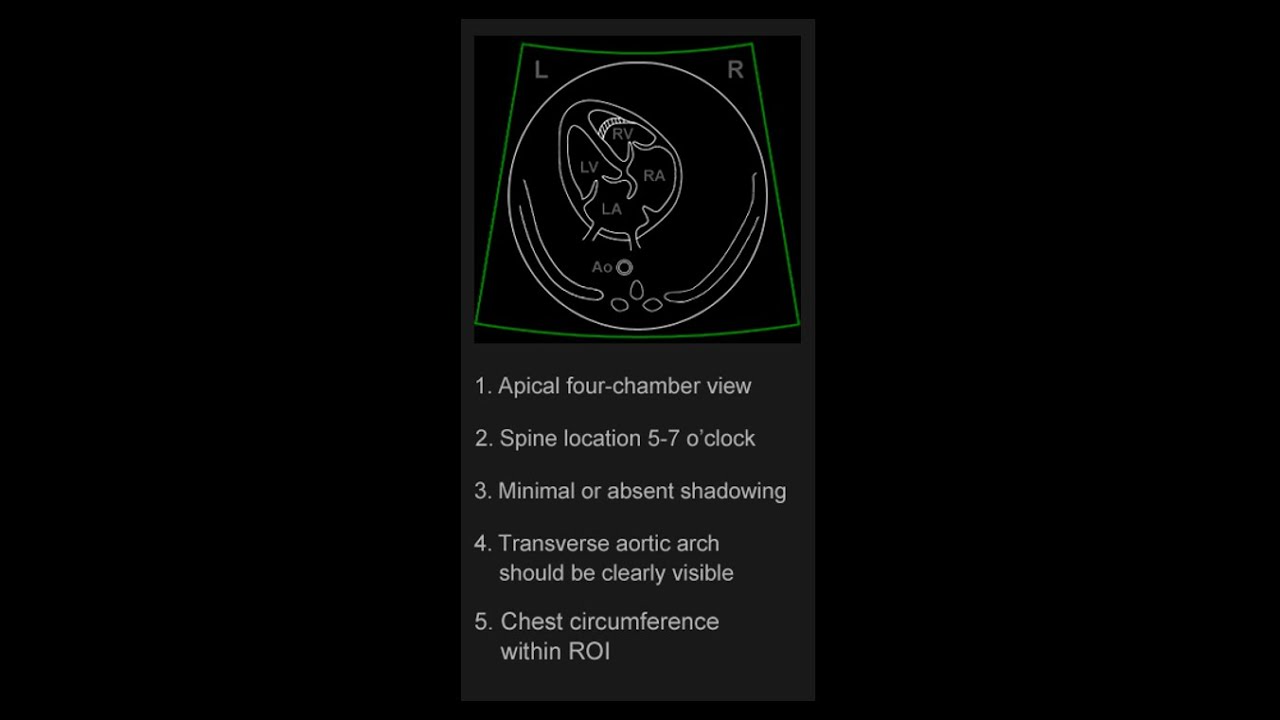 6_STIC PART 3: ACQUISITION PROCESS