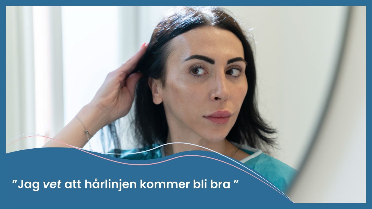 Jag vet att hårlinjen kommer att bli bra | Nordic Hair