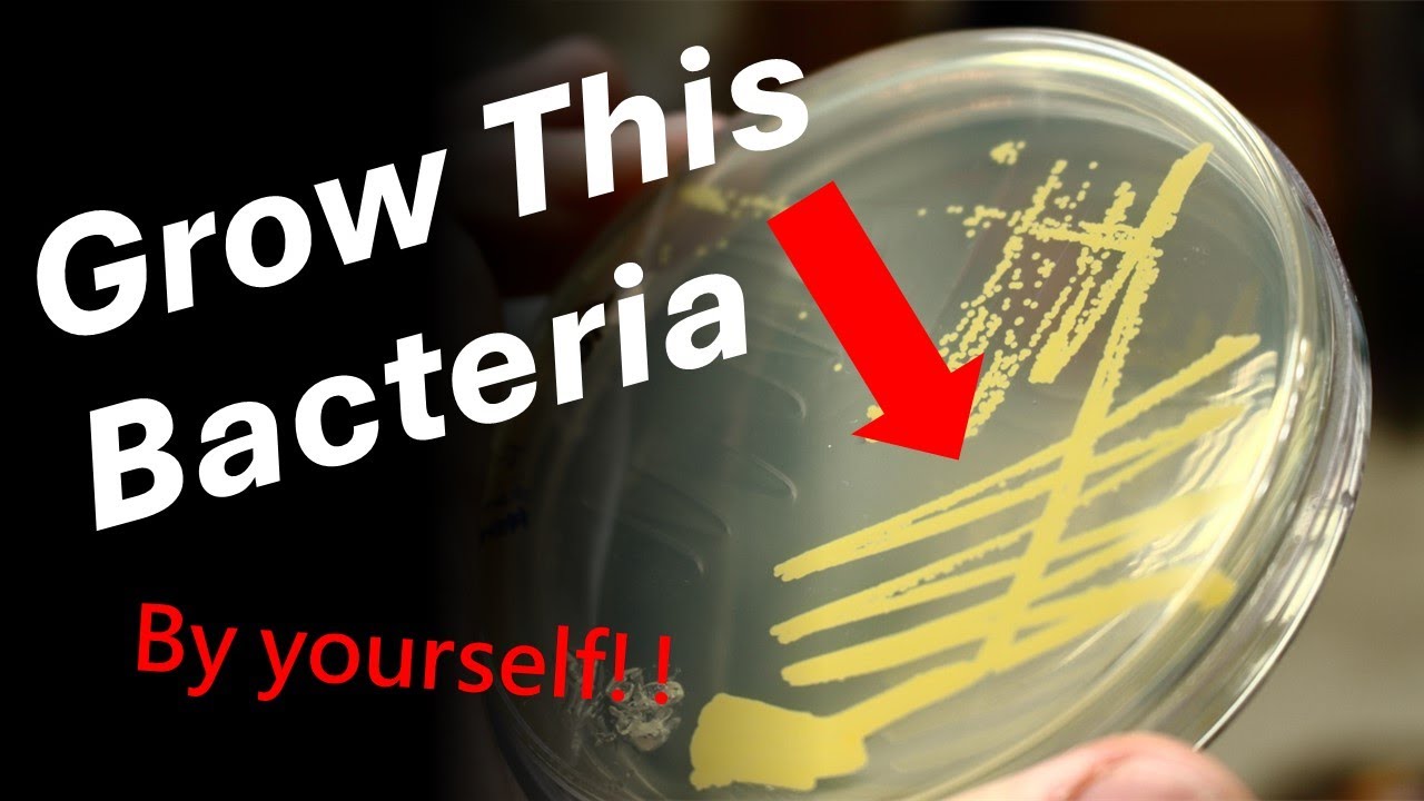 Bacteria On Your Body- Staphylococcus aureus
