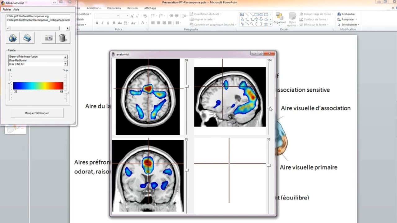 [eSVT] Circuit de la r&eacute;compense et le d&eacute;clenchement du plaisir