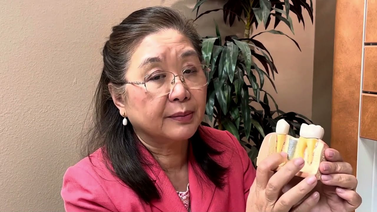 Dental Implants - Dr. Myrna Lazaga, DMD