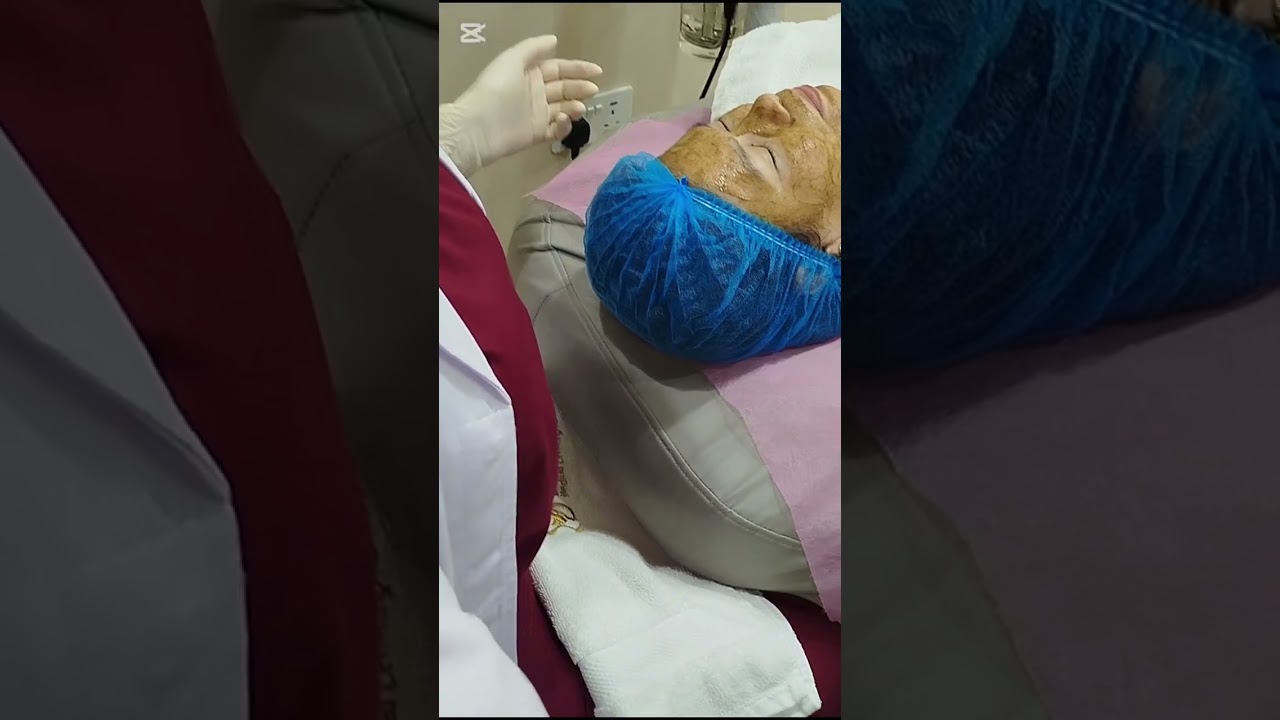 Melasma facial treatment free demo ❤️