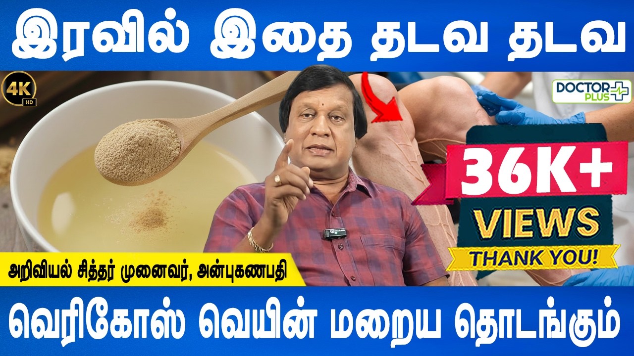 கடுமையான வலி குறையும் | SURGERY-FREE VARICOSE VEINS CURE! The Ultimate Natural Remedy | Doctor Plus