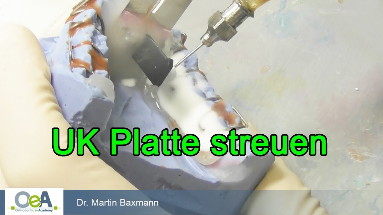 UK Platte streuen I OeA