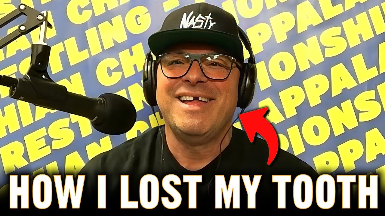 Jerry Sags Reveals How He Lost His Tooth