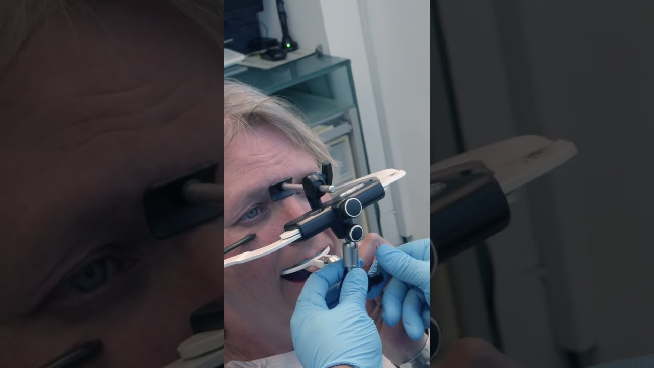 Facebow recording | perfect smile & bite | dentist dentistry #shorts #health #beauty