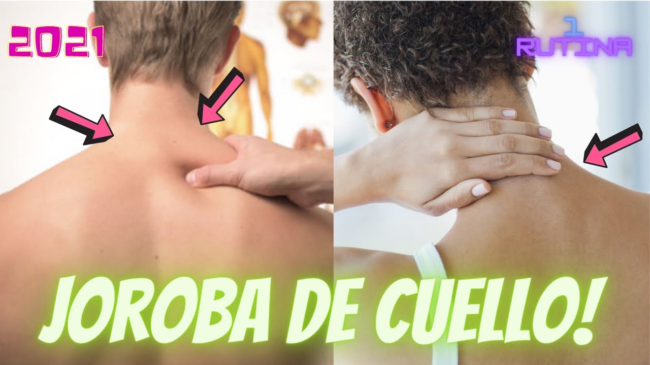 Ejercicios para la joroba de cuello/cómo quitar la joroba de búfalo