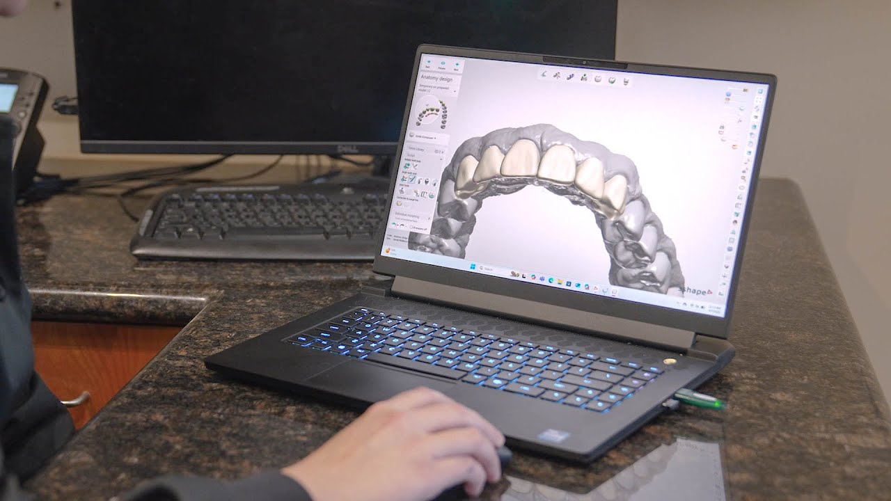 Life-Changing Results with Dental Crowns | Hear One Patient’s Story