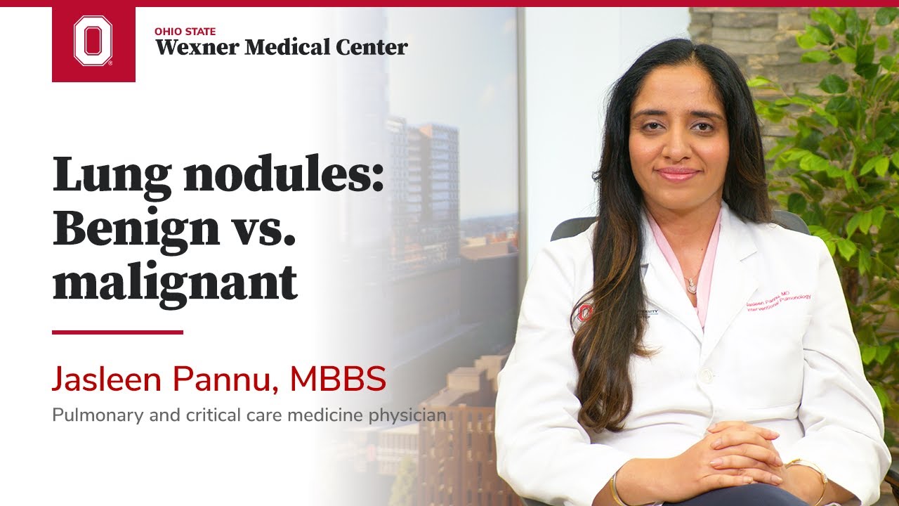 Lung nodules: Benign vs. malignant | Ohio State Medical Center