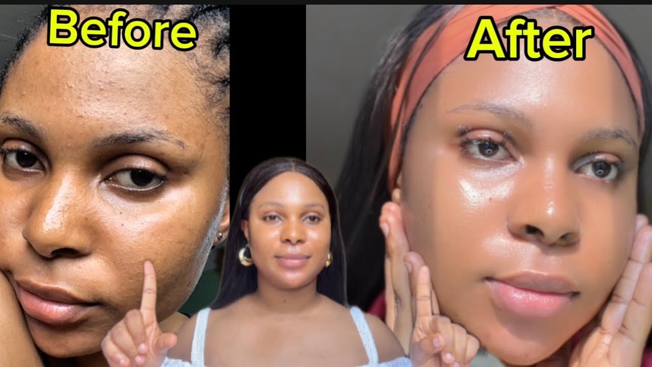 How to get rid of textured skin: How I got a smooth skin texture