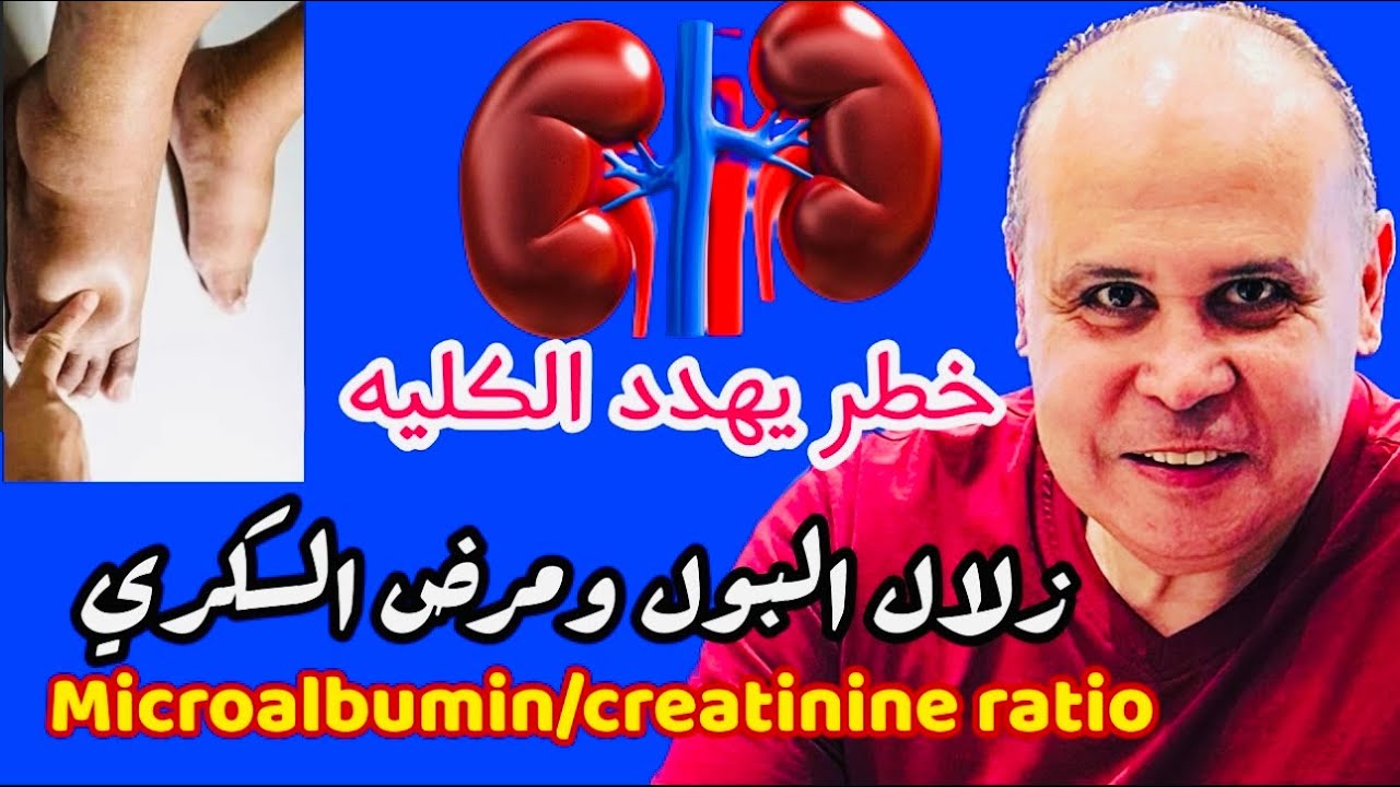 لن تصدق ..علامات تدهور وظايف الكلي 👈زلال البول وتورم القدمين ومرض السكري 👌MICROALBUMINURIA