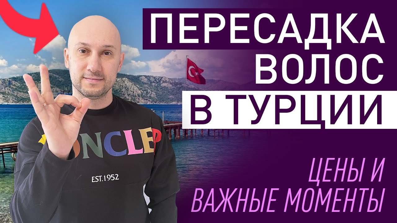 Все о пересадке волос - за 3 минуты. Что надо знать и понимать