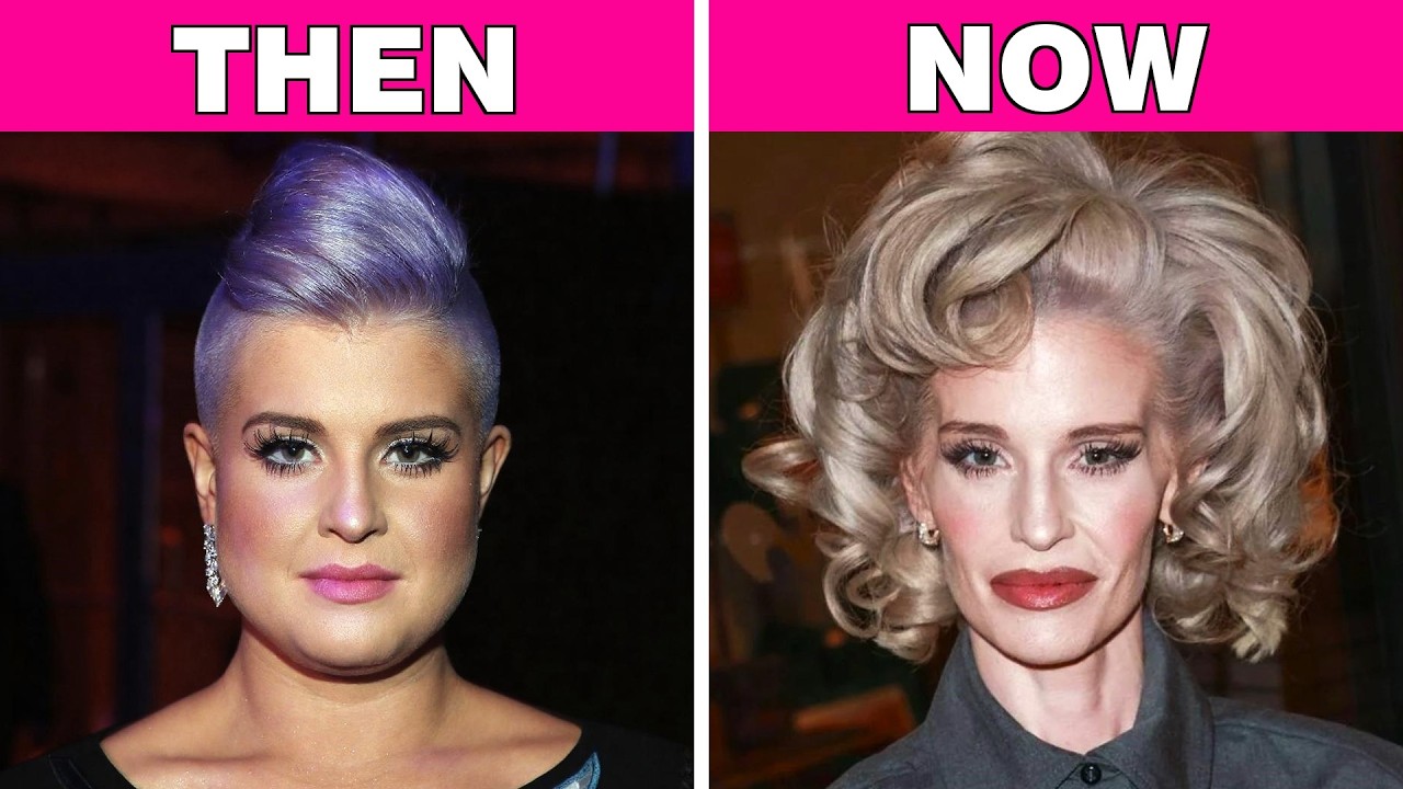 80+ Celebrity Transformations So Extreme Fans Are Worried | Then and Now