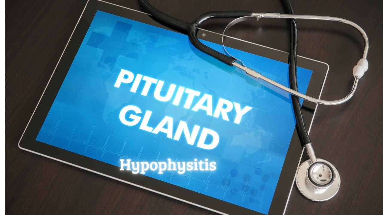 Hypophysitis: Ursachen, Symptome & Behandlung | Was Betroffene wissen müssen