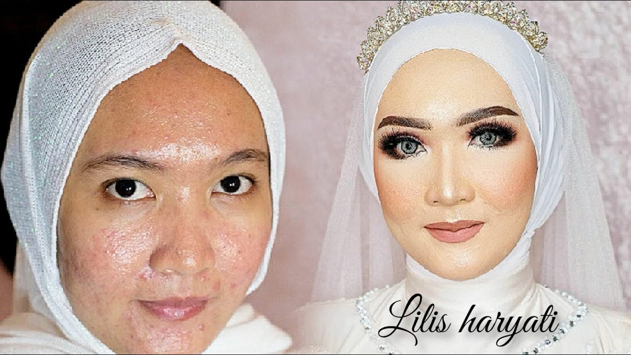 MAKEUP PENGANTIN WAJAH BERJERAWAT