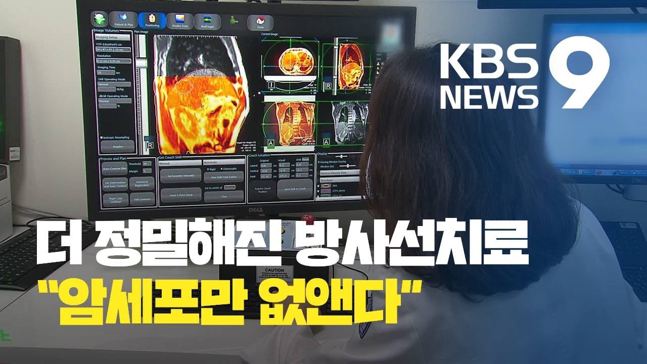&lsquo;MRI로 암 위치 추적&rsquo;&hellip;더 정밀해진 방사선치료 / KBS뉴스(News)
