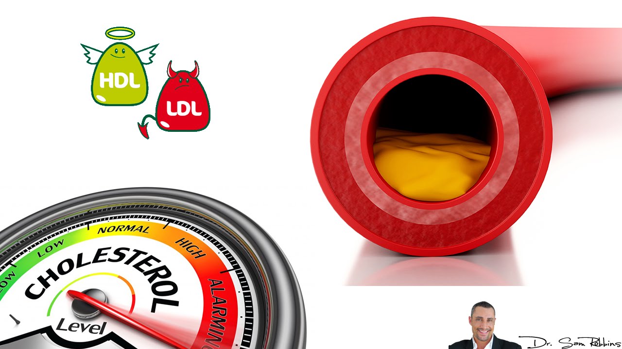 Cholesterol Levels Chart Explanation - HDL and LDL cholesterol - by Dr Sam Robbins