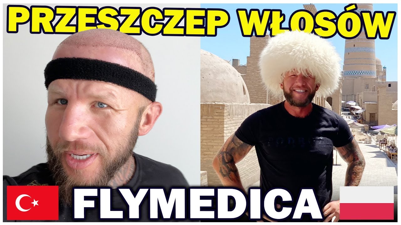 Przeszczep Włosów Turcja - mój drugi zabieg z flymedica (Istambuł)
