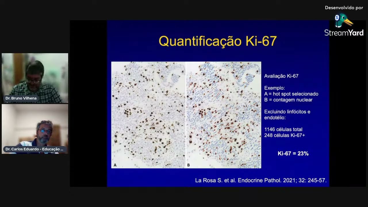 Diagnóstico, estadiamento e tratamento dos Tumores Neuroendócrinos. O que preciso saber em 2023?